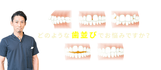 どのような歯並びでお悩みですか？