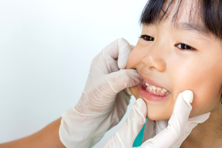 子どもはなぜ歯医者さんを怖がるの？