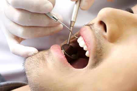 口臭の原因となる歯周病対策