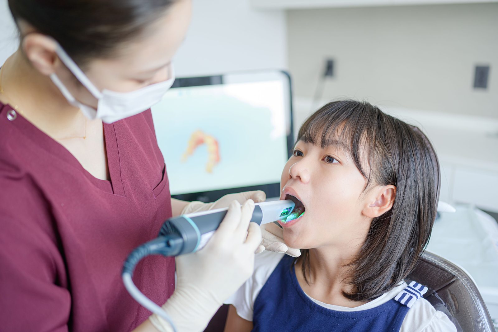 口腔内スキャナーで歯型を読み取っている様子